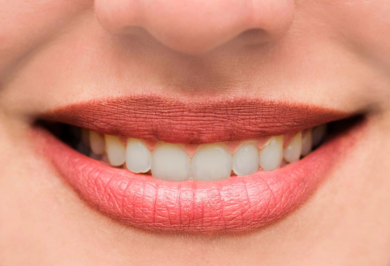 woman s lips and teeth smile close up3.jpg